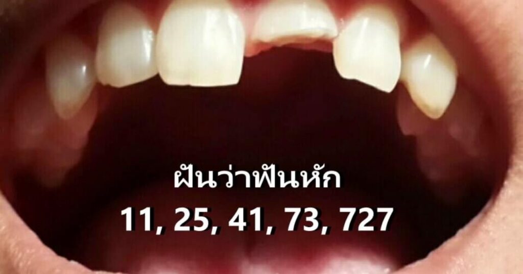 ฟันหลอ 